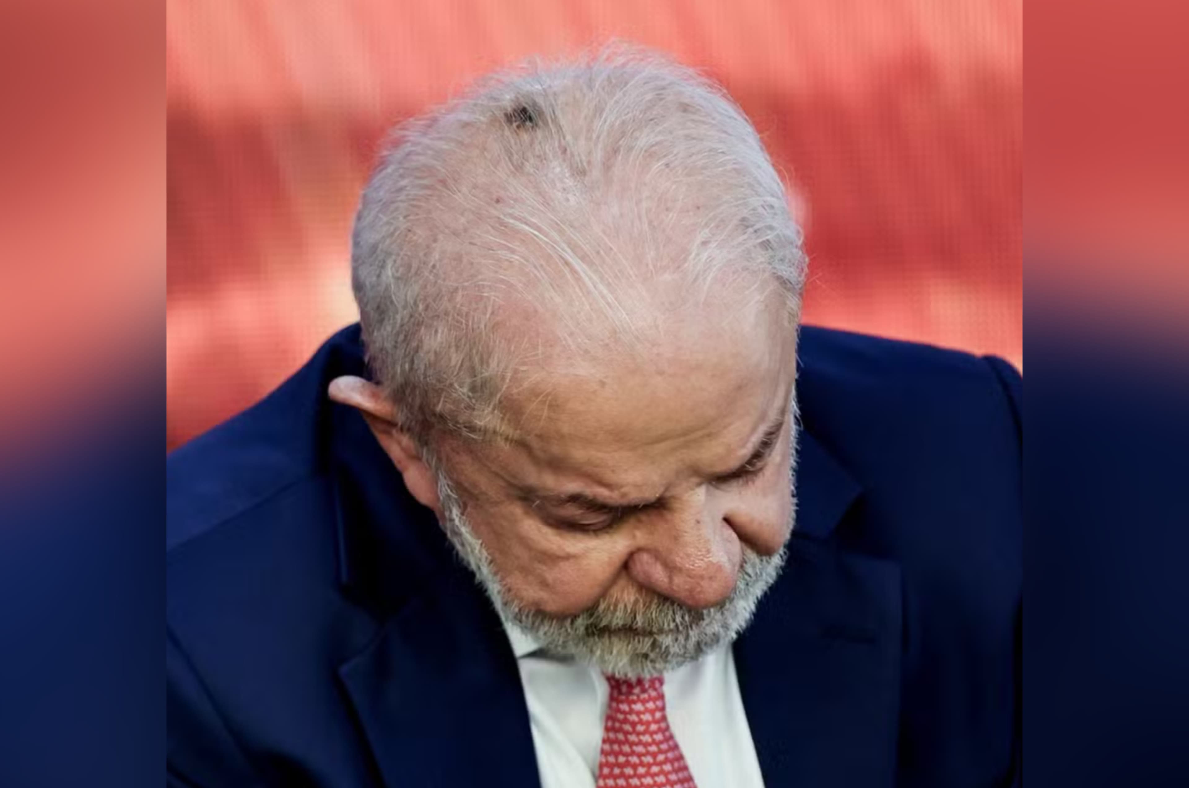 Presidente Lula passará por procedimentos médicos em São Paulo nesta sexta-feira