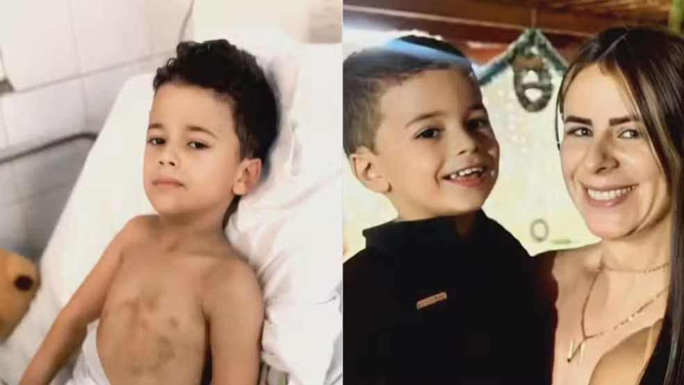 Menino de 5 anos que caiu de prédio em Caruaru não corre mais risco de vida