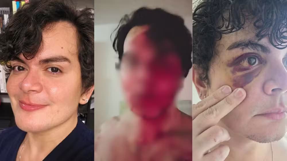 Dermatologista denuncia agressão homofóbica após invasão de apartamento no Recife