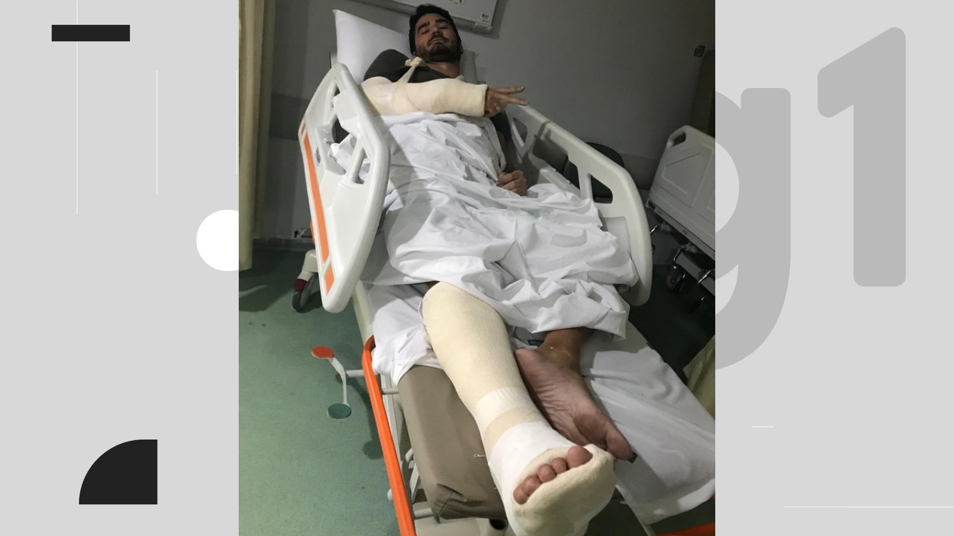 Ciclista é atropelado por patinete elétrico em ciclofaixa do Recife e levanta debate sobre segurança