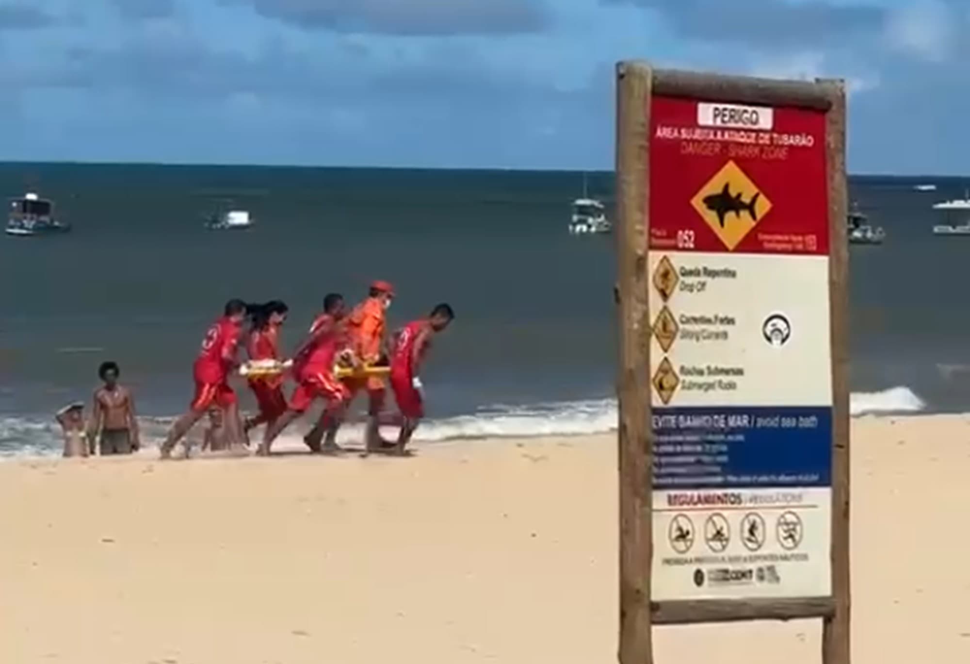 Menino de 11 anos sofre amputação após ataque de tubarão em Piedade