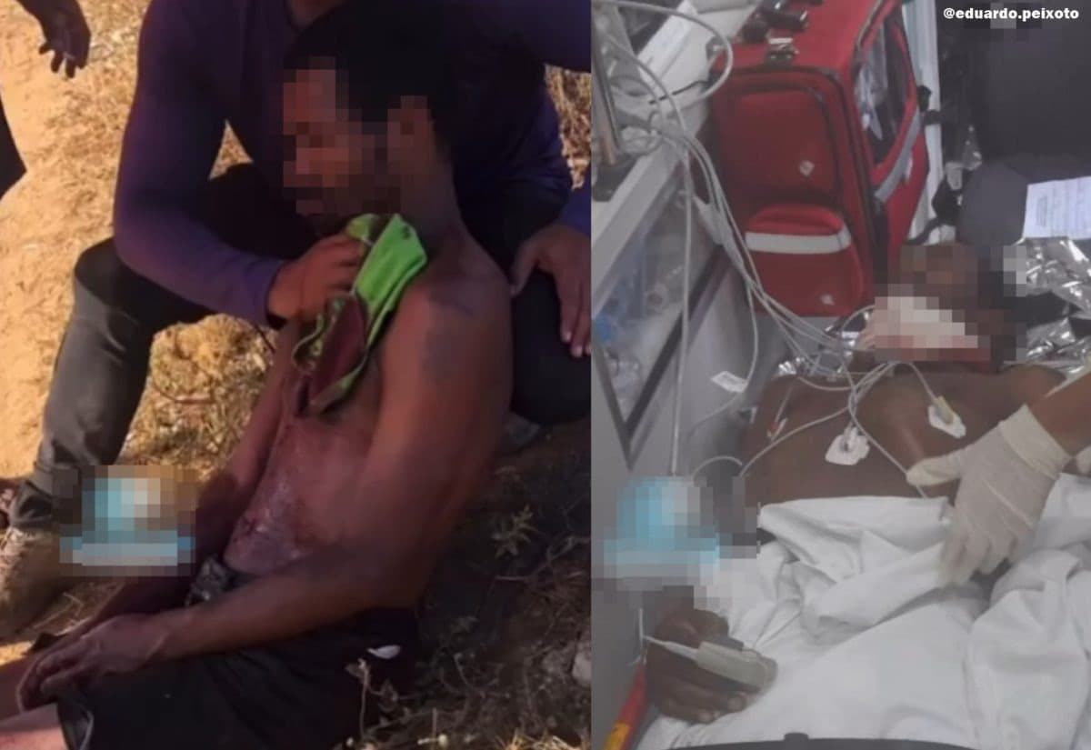 Homem fica gravemente ferido após ter pescoço atingido por linha com cerol em Garanhuns